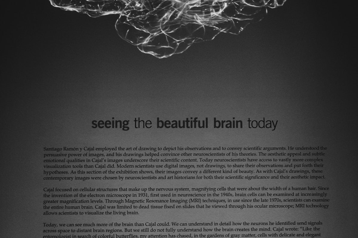 Neural network brain connections